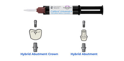 Cementation of hybrid abutment crowns and hybrid abutments using Calibra Universal resin cement