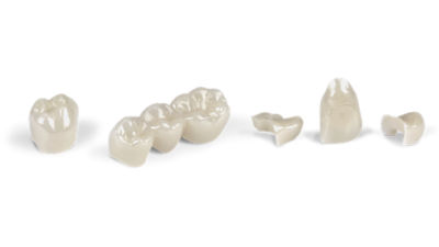 Comparison chart of CEREC Cercon 4D and other zirconia blocks showing indications for crowns, bridges, veneers, inlays, onlays, and abutments