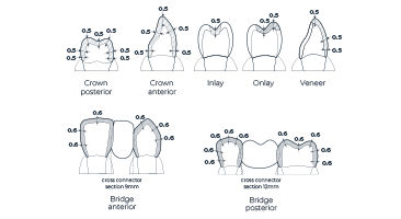 Minimum wall thickness guidelines for CEREC Cercon 4D zirconia restorations including crowns, inlays, onlays, veneers, and anterior/posterior bridges