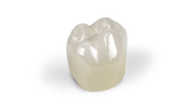 Single CEREC Cercon 4D zirconia crown shown on a light background.