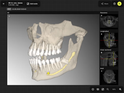 Cloud Solution for Dentists: Clinical applications for streamlined ...