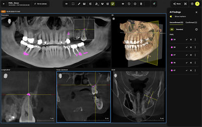Cloud Solution for Dentists: Clinical applications for streamlined ...