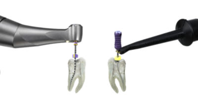 Dental handpiece and obturation device working on molar models, demonstrating efficient precision.