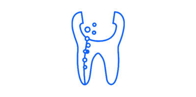 Irrigation needle icon with liquid spray lines, surrounded by a red gradient circle.
