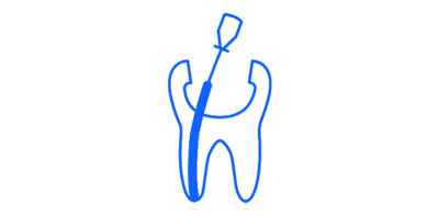Outlined tooth icon with a gutta-percha point inside, surrounded by a green gradient circle
