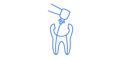 Outlined tooth icon with a shaping file inside, surrounded by an orange gradient circle.