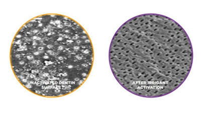 Close-up comparison of root canal cross-sections illustrating the effect of active versus passive irrigation.