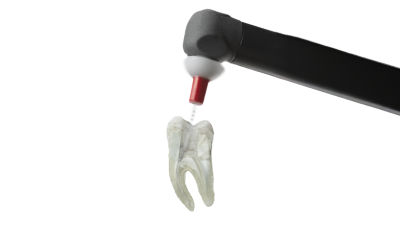 Close-up of flexible plastic EndoActivator tip inside a root canal.