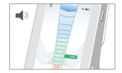 X-Smart Apex Locator display with audio symbol, showing feedback interface for root canal measurements.