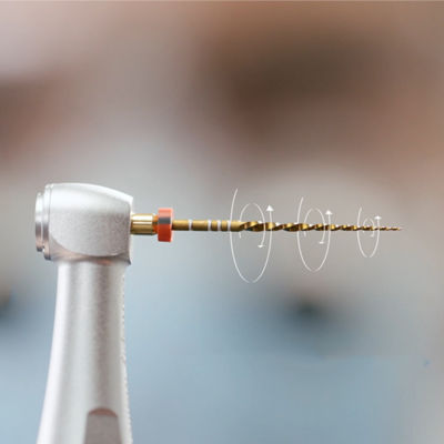Close-up of a dental handpiece holding a WaveOne Gold endodontic file during a root canal preparation.