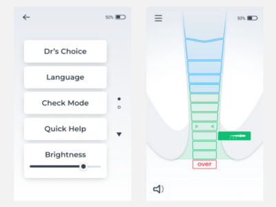 Close-up of X-Smart Apex Locator screen showing user preference menu and position indicators.