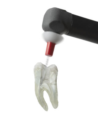 Dental tool SmartLite Pro EndoActivator shown for optimized irrigation in endodontic treatment.