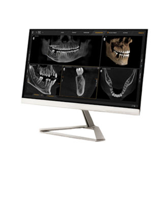 MAGNETOM Free.Max Dental Edition: ddMRI & Treatment | Dentsply Sirona ...