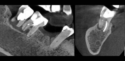 MAGNETOM Free.Max Dental Edition: ddMRI & Treatment | Dentsply Sirona MENA