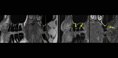 MAGNETOM Free.Max Dental Edition: ddMRI & Treatment | Dentsply Sirona ...