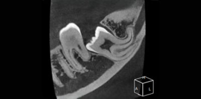 MAGNETOM Free.Max Dental Edition: ddMRI & Treatment | Dentsply Sirona HR