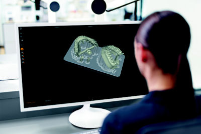 Dental professional using manufacturing software to prepare 3D printed dental models on screen.