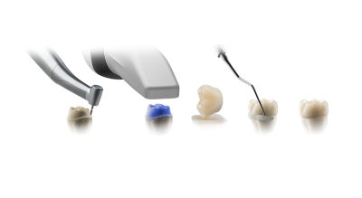 Sequence showing a digital intraoral scanner, provisional crowns, and tools for same-day in-office crown production