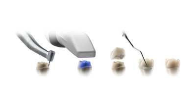 Sequence showing a digital intraoral scanner, provisional crowns, and tools for same-day in-office crown production