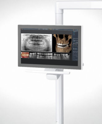 MAGNETOM Free.Max Dental Edition: ddMRI & Treatment | Dentsply Sirona MENA