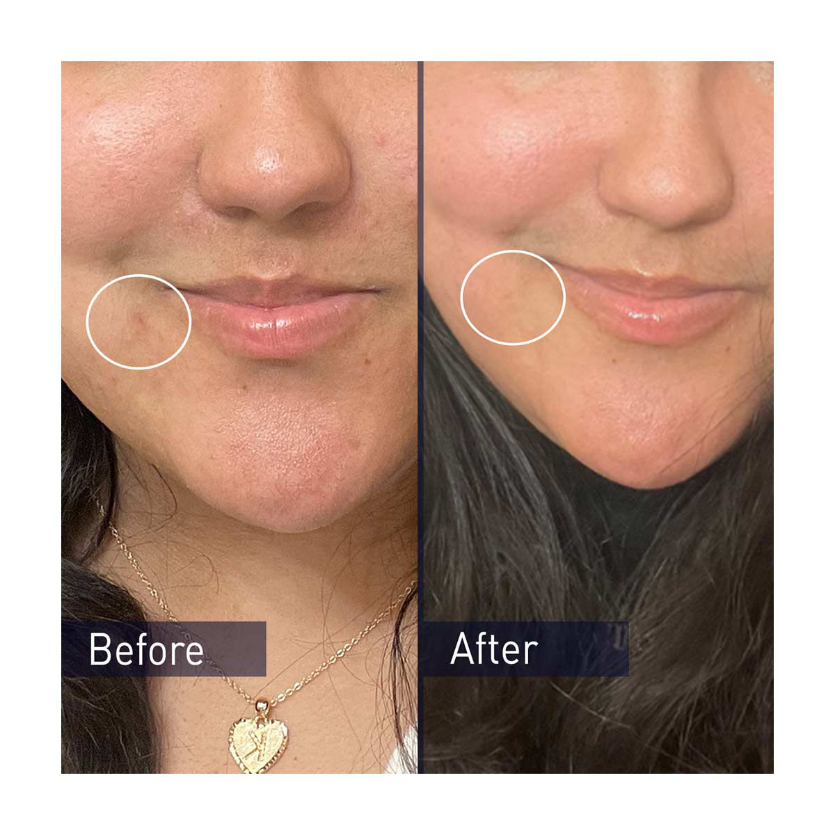 PanOxyl Acne Foaming Wash, 3 oz