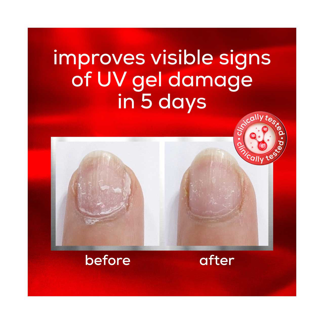 essie To the Rescue UV Gel Damage Repair Nail Treatment, 0.46 oz