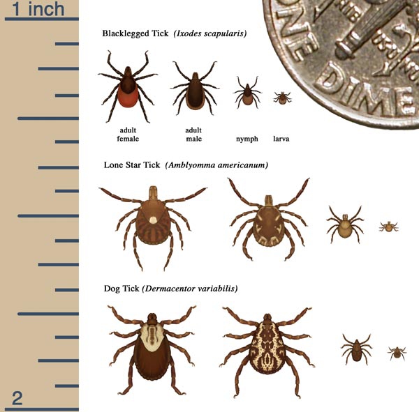 babesiosis