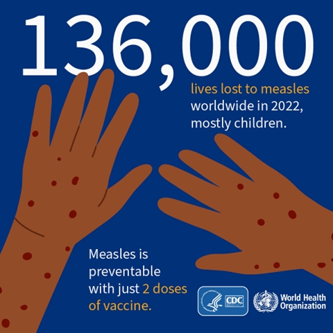 Measles is preventable, but remains a threat worldwide, and in the United States.