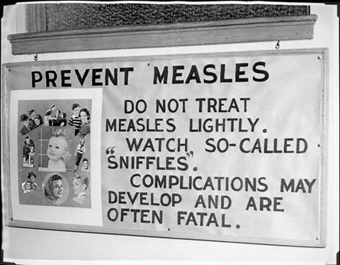 Prevent Measles. Do not treat Measles lightly. Watch so-called sniffles. Complications may develop and are often fatal.