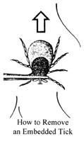proper removal of a tick