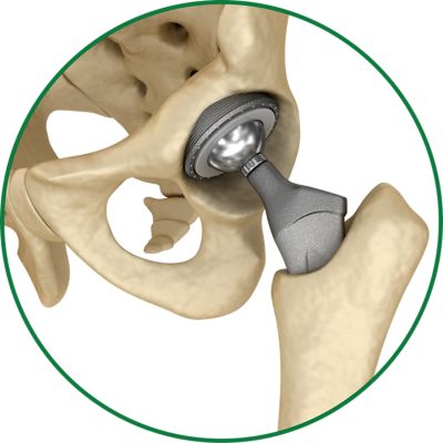 Hip Joint