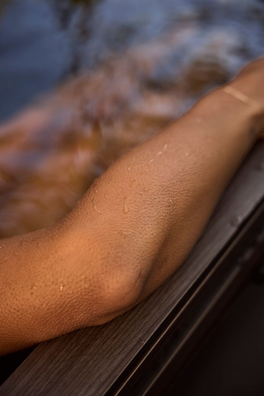 A woman's arm on the ledge of an ice bath.