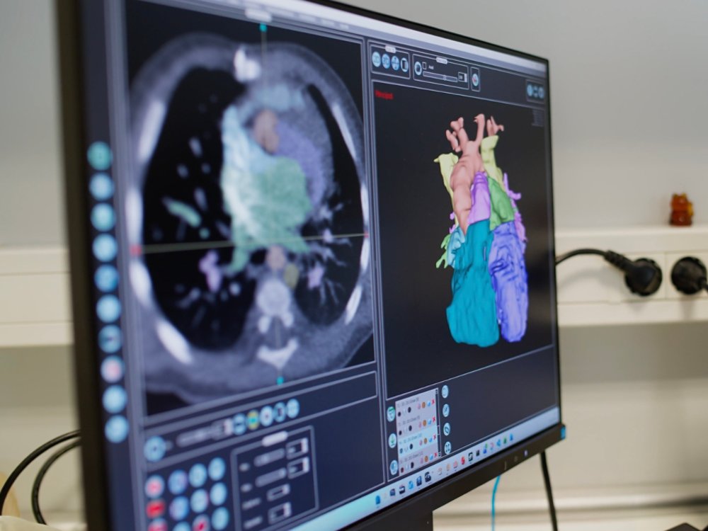 monitor-showing-heart-image
