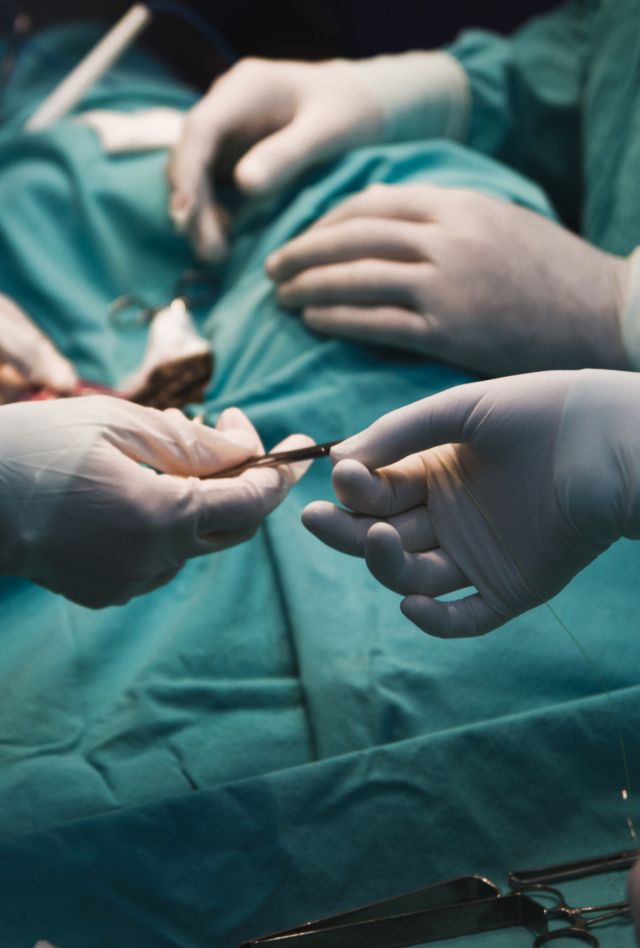 Unrecognisable Medical team performing surgery close up in the action - Hands with white gloves - green scrubs.