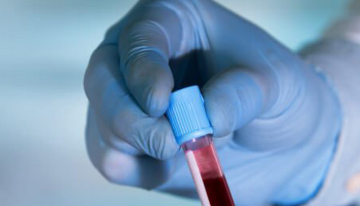 SemiAutomated Testing Ortho Clinical Diagnostics