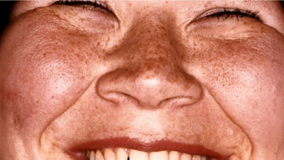 Click image of child with bright smile Opens pdf