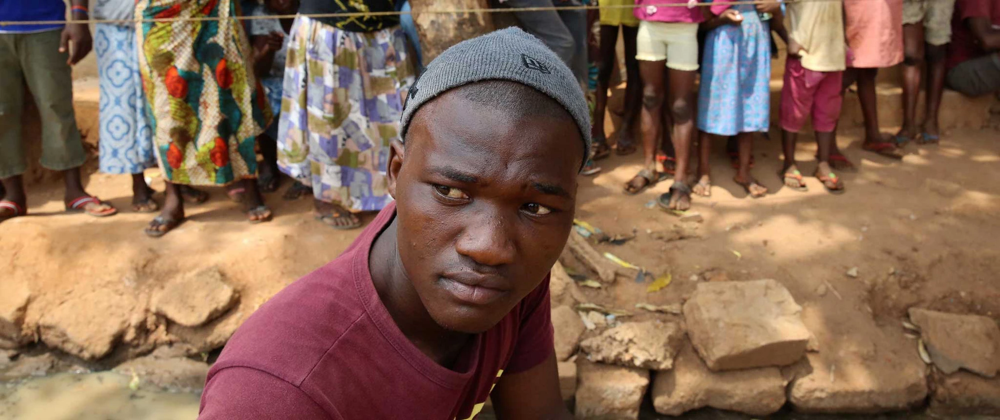 An ebola survivor, Sierra Leone