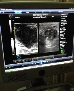 Ultrasound scan image easier to diagnose, produced with two modes of the ultrasound imaging technology ? Shiro Nakata