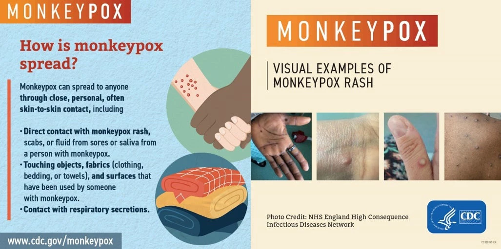 Figure 2: Examples of monkeypox communication materials