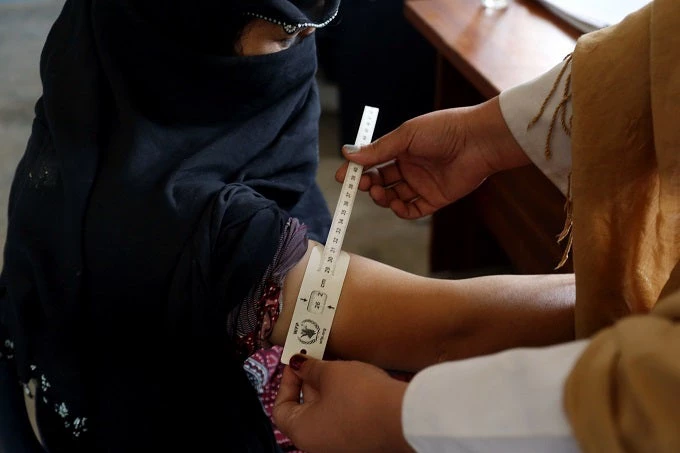 A woman visits a Comprehensive Health Center (CHC) in Tani district of southeastern Khost Province. The gynecology department of Dargai CHC receives an average of 50 patients per day and carries out three to four deliveries per 24 hours.